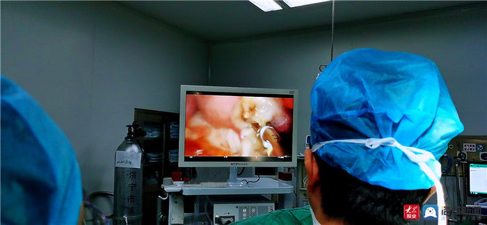 气腹|东平县第一人民医院妇产科成功开展首例腰硬联合麻醉经阴无气腹腹腔镜手术