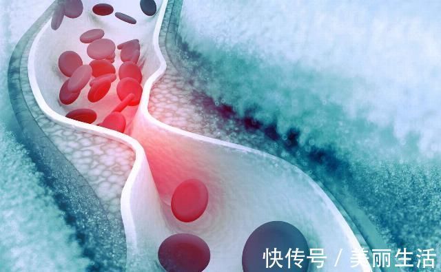 本草綱目|中藥刺五加有哪些功效，寧得一把五加，不用金玉滿車