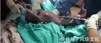 胎膜|顺产到底有多疼,给你们看完这18图片,就能真正理解女人不容易