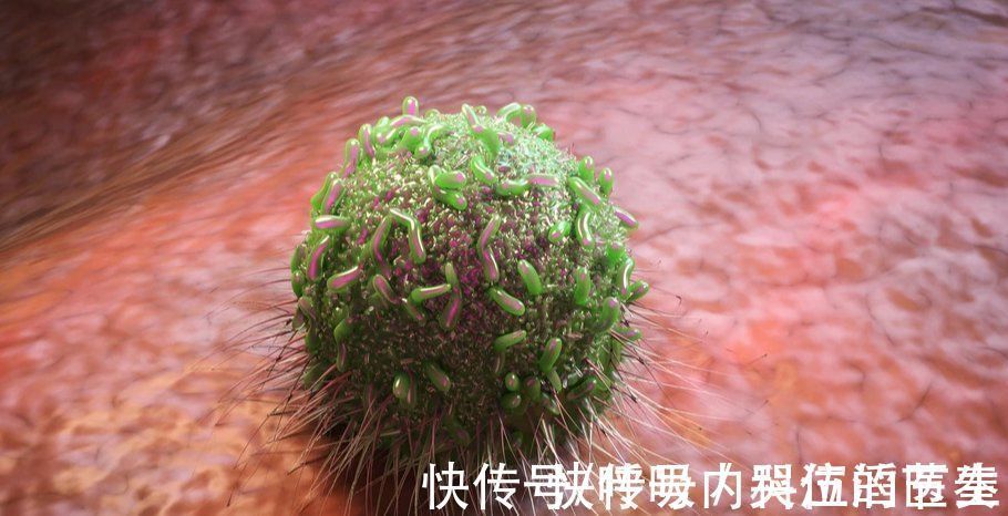 养生|59岁的养生专家,因肠癌去世,为何生活健康的人也会患癌?