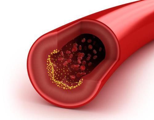 高血压|乡下土里长出来的降压药,高血压吃一个降一个,血压根本高不起来