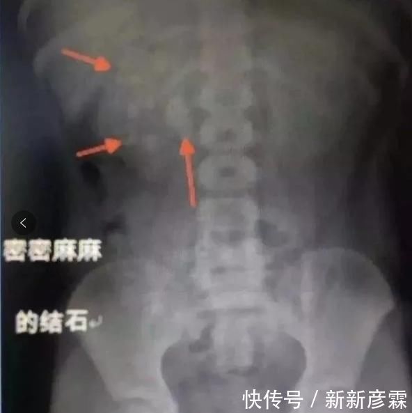黑名单|宝宝六个月前“育儿黑名单”出炉,米糊糖水皆上榜,不利孩子发育