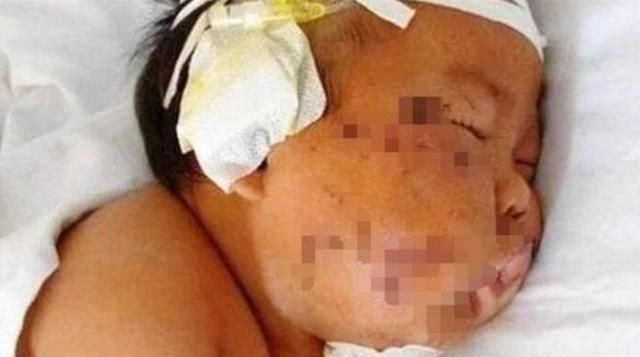 怀孕期间|因吃奶太用力,被妈妈用剪刀划花的男孩,如今怎么样了