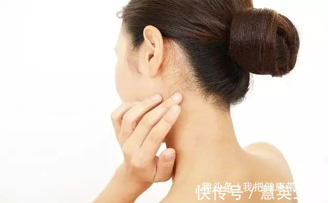 蒲公英|40岁左右女性,脖子上常发现“结节”,了解下五种“天然散结药”