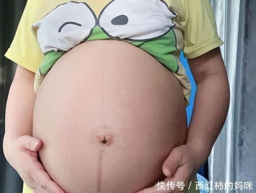 妈妈们|为何孕晚期会诊断畸形?过四维彩超,准妈妈也不能大意