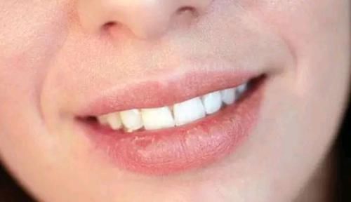 这4个坏习惯，会让女生的嘴唇越来越丑！你也有的话，尽量改掉吧