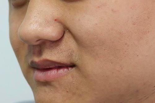 气体|老放屁，是肝癌前兆？大夫提醒：屁多，要重视3个“异常”！