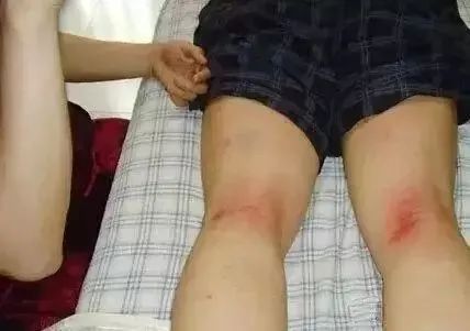 八虚|人体有8虚，学会拍一拍，清肺气化肝郁健脾胃通经络，百病远离！