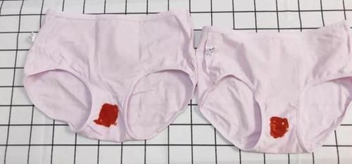 月经期间|女性月经期间不可以洗头？医生提醒：真正要少做的是这5件事