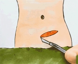 剖宫产史|一胎二胎剖腹产,第三胎怀孕有6个风险