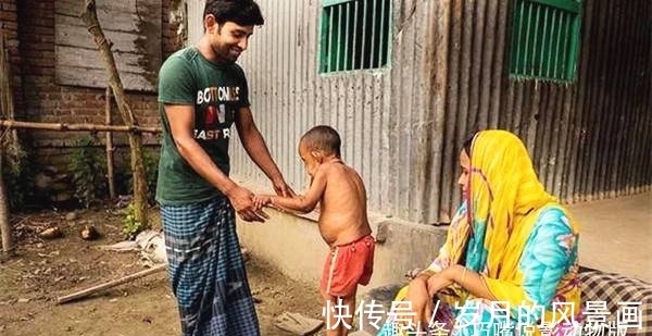 儿童早衰症|印度男童,患怪病,智商超群却长着一副80岁面孔