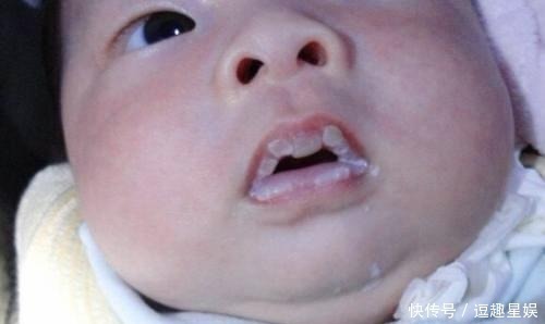 谷氨酸钠|3天新生儿喝母乳后就去了医院,医生检查后发现,还是妈妈惹的祸