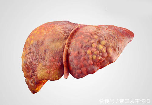 葛根|护肝“高手”公布了,不是猪肝,平时可劲吃,肝一天天“好”起来