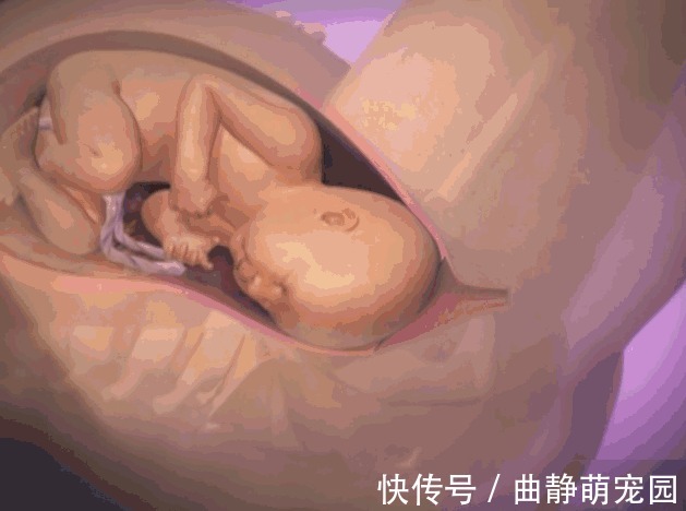 宫缩|胎儿分娩前在忙什么?忙着收拾东西出来呢,过来人的说法很真实