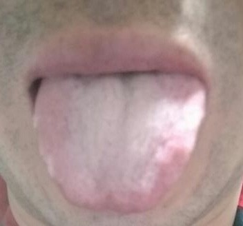 津不上承|老中医告诉你一到晚上就口干口渴的厉害是怎么回事