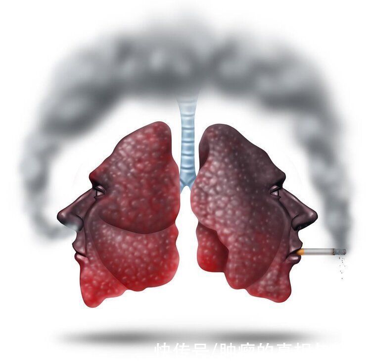 吸烟|临床观察发现，国内不吸烟人群肺癌发生率更高？是谣言还是真相