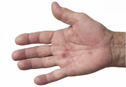 肝脏|喝酒时,若出现4个迹象,预示着肝硬化或已来报道