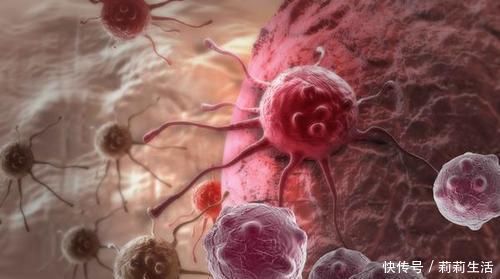 慢性胃病|父母有以下3类癌症，子女就要警惕起来了！最好定期检查