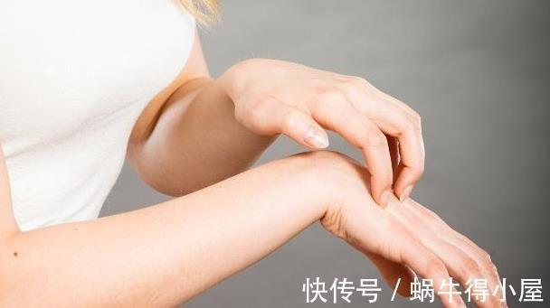 疼痛|34岁的妇女患有皮疹,身体检查发现患有肺癌,因为忽视了一些变化