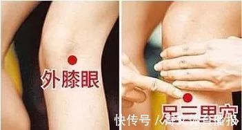 艾灸|大家好!我叫“息肉”,癌症的近亲!我最怕无情又温柔的手术刀:艾灸