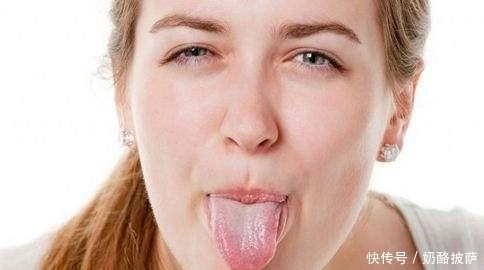  颜色发|提醒：如果你的舌头是3种颜色，要当心，很可能是健康出了问题