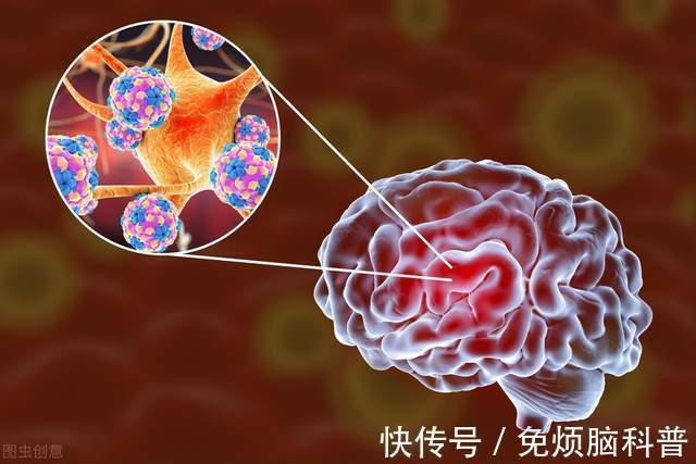 血压|高血压不重视，清晨突发脑梗离世，这3大并发症，早预防早脱险