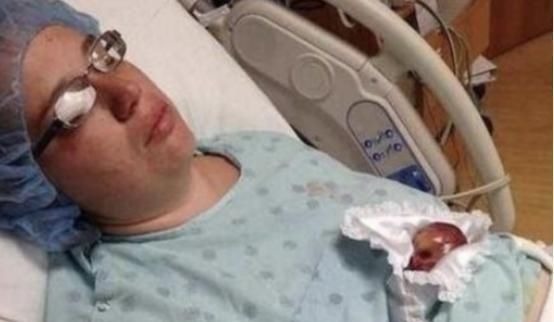 摇篮|曾经的最小婴儿用蛋壳当摇篮,现在13年过去了,她怎么样了