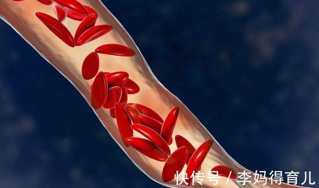 高血脂|提醒大家：血脂逐渐升高，或和这3类食物有关，劝你少碰