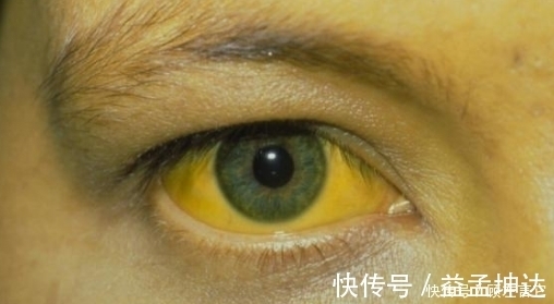 咸菜|饭桌上2物，已被世卫组织拉入黑名单，劝告：为了肝健康，需忌口