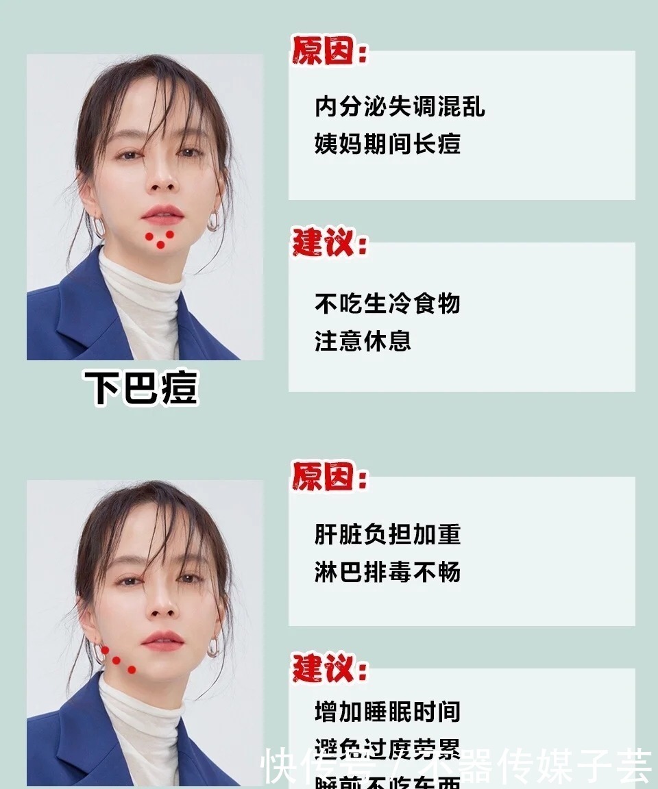 生冷食物|二十几了还长痘?别再用烂脸的招数了,几招教你养出水润肤质