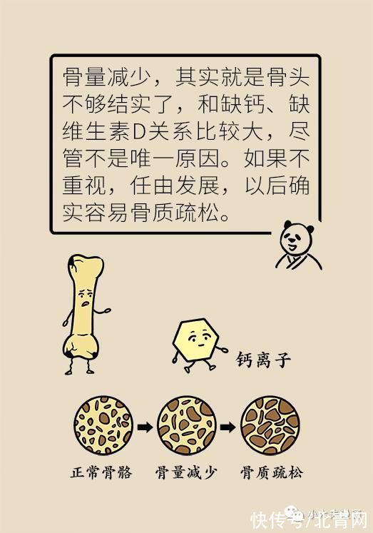 骨量|怕骨折，去补钙，会补出肾结石吗？骨量减少应该这么解决