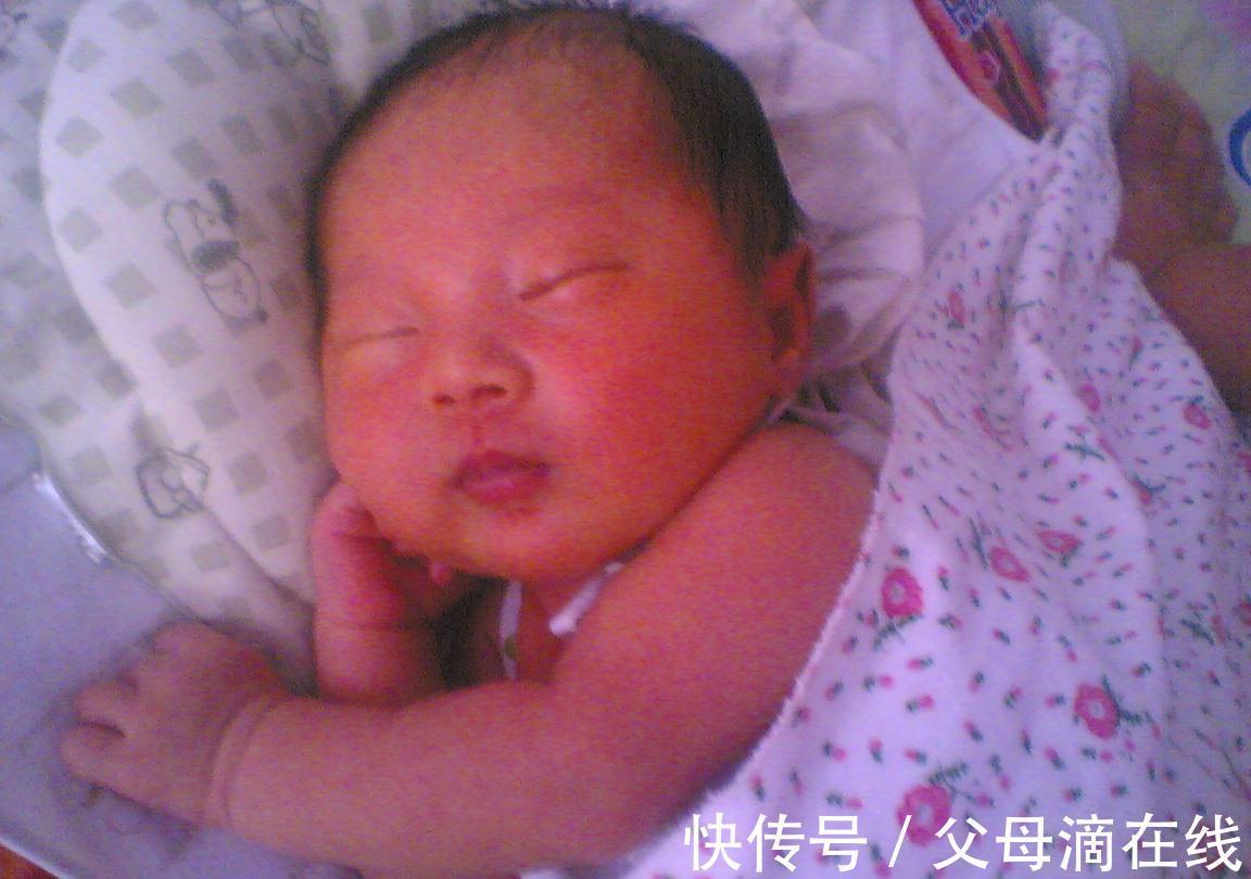 新生儿|孕期这三类食物吃得越多,宝宝出生后黄疸越明显,为了宝宝忍一忍