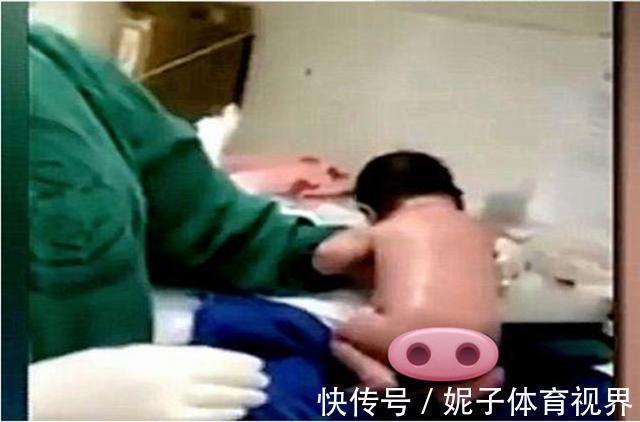 宝妈|“怕疼新生儿”走红,刚出生脐带还没剪就想跑,医生:发育得很好