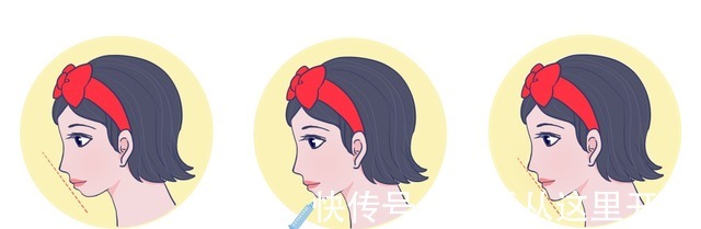 科普 下巴对面部轮廓的影响有多大如何拥有精致下巴|医美科普!