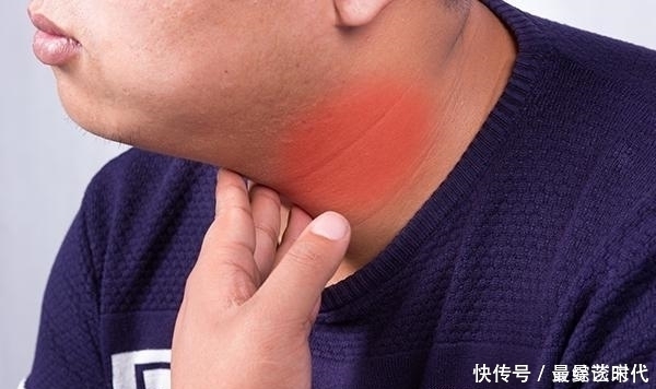 甲狀腺|查出甲狀腺結節,就和海鮮無緣了嗎?醫生:真正要忌口是2種食物