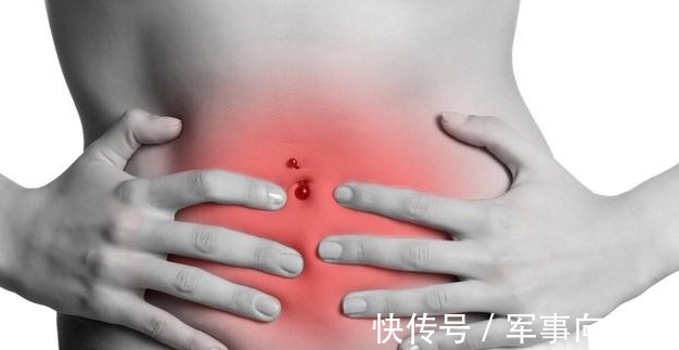 阿姨|45岁阿姨便秘半年,一查是肠癌晚期,身体出现3个症状,要小心