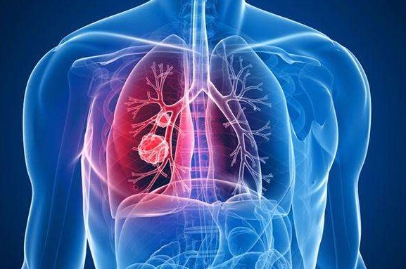 药物|女子一天要吃3次“伟哥”，连续十年不间断，昂贵费用成家庭负担