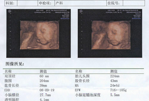 孕酮|确定怀孕后，第一次产检是在什么时候？超过这个时间，就晚了