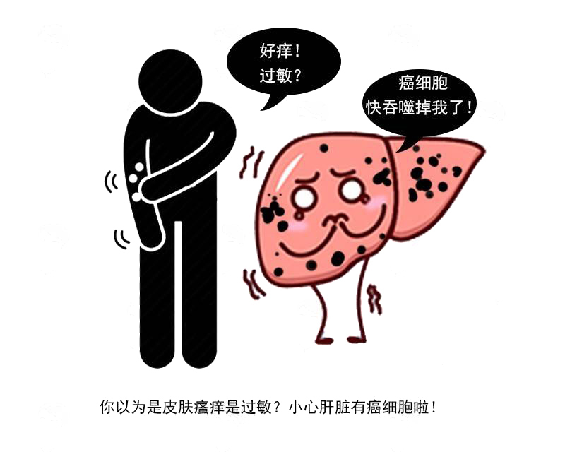 肝脏|肝好不好,看皮肤就知道?皮肤出现4种异常,或是肝癌早期信号