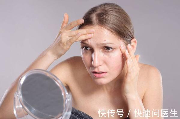 彩妆 脸上长了痘痘?不用着急,分享4招,帮助脸庞恢复白净