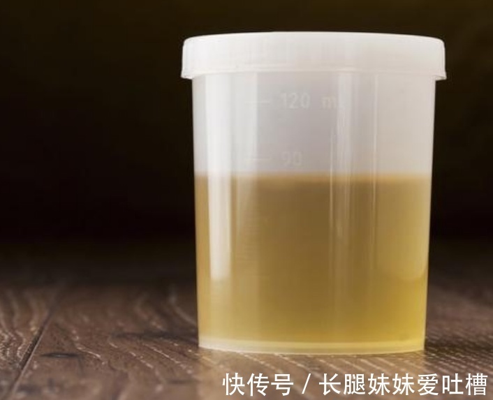 血糖|糖尿病最“怕”3种食物，多吃两口，血糖乖乖“掉下来”！