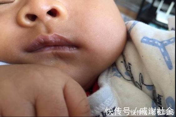 一日三餐|“脾胃虚”的宝宝,身上这2个部位经常出汗,父母早了解娃早受益