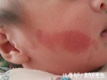 准妈妈|怀孕后,几件事孕妇最好不要干,要不然出生的婴儿可能有胎记