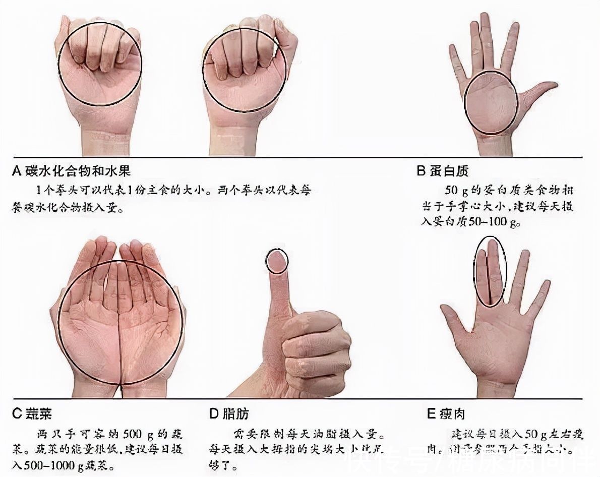 糖尿病并发症|糖尿病人注意四个点，吃饭不怕血糖高