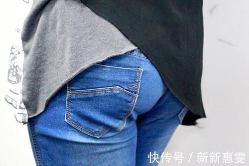 皮肤过敏|肛门上长有肉疙瘩,是痔疮吗?看了之后,你会知道答案