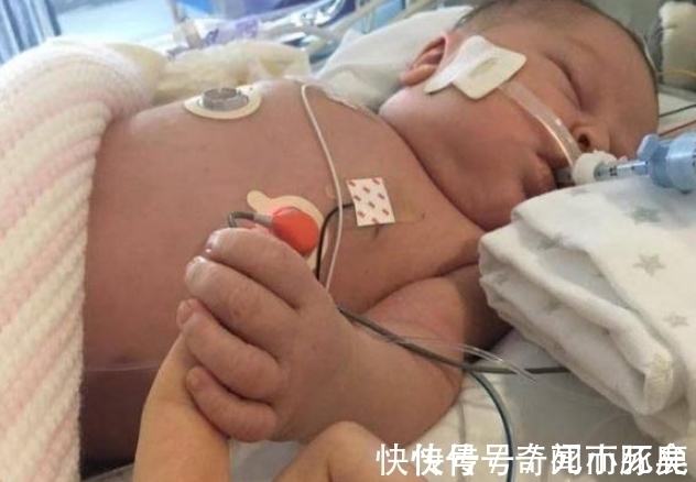 病菌|婴儿一出生就被感染病菌，在拔掉呼吸机的时候，她紧握母亲的手指