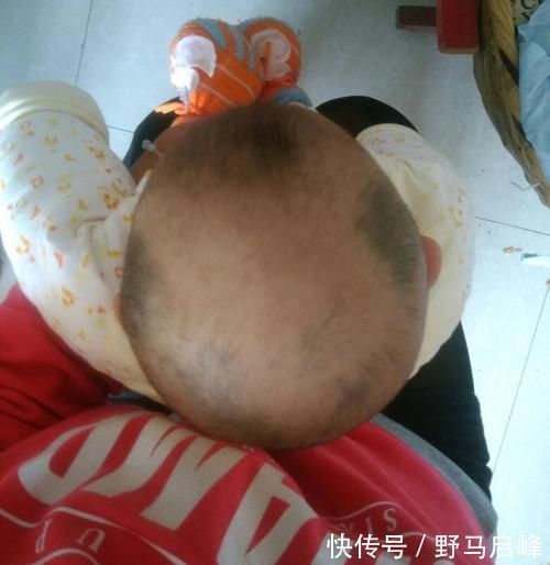 发量|同是新生儿为啥有些头发浓密,有的是小秃头,这3个原因要重视