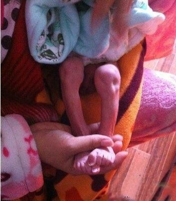 医生|宝宝出生25天就像个小老头,医生的一席话,让父母恨自己也太不上心了