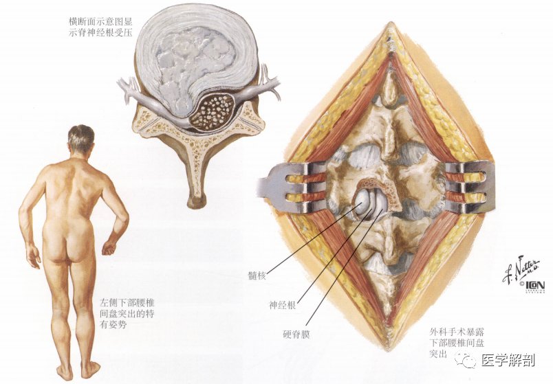 脊髓与脊神经|奈特解剖图谱 | 解剖图谱