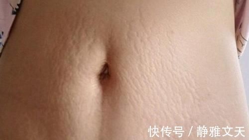 涂抹|可怕的不是妊娠纹,而是没有提前做预防,防纹三部曲走起!